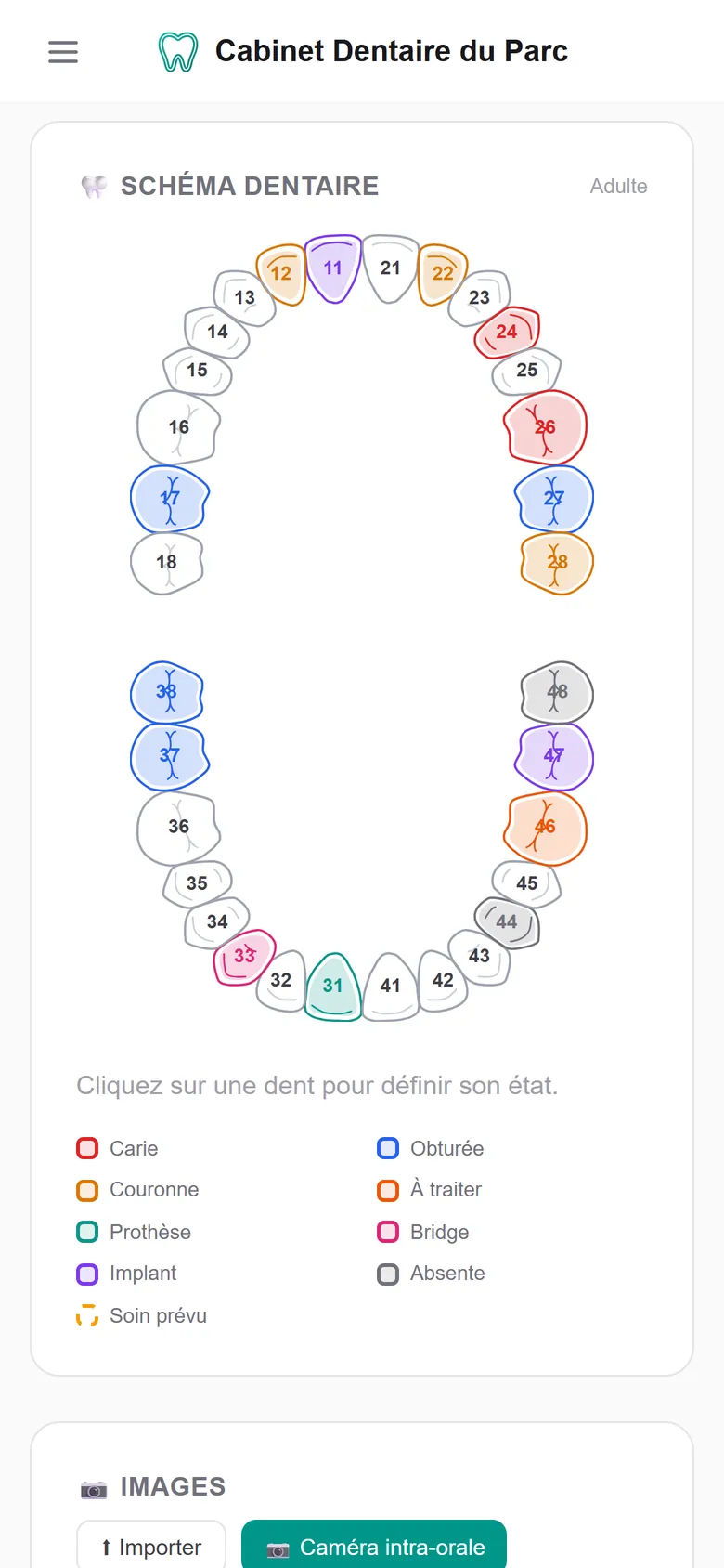 Schéma dentaire — DentiCareApp